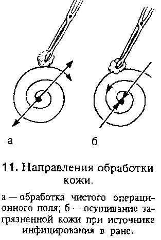 Ассистирование при хирургических операциях